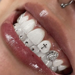 Formation en ligne - Strass Dentaire